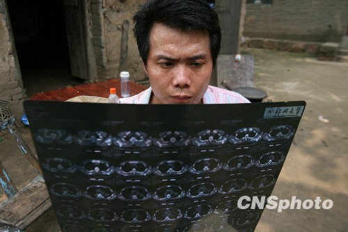 河南"開(kāi)胸驗(yàn)肺者"低保被取消 河南"開(kāi)胸驗(yàn)肺者"低保被取消