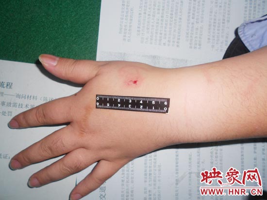 為幫助無證駕駛的朋友逃避處罰，新鄉(xiāng)的王某竟對執(zhí)勤民警大打出手，還將一名民警的手臂咬傷