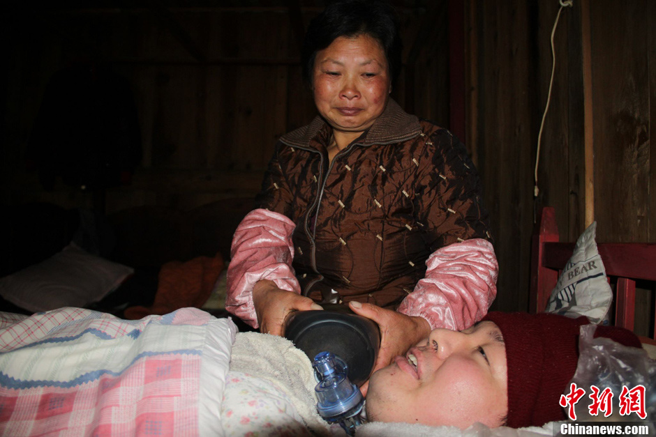 父母為癱瘓兒子自制呼吸機 手捏呼吸球5年不輟 父母為癱瘓兒子自制呼吸機 手捏呼吸球5年不輟