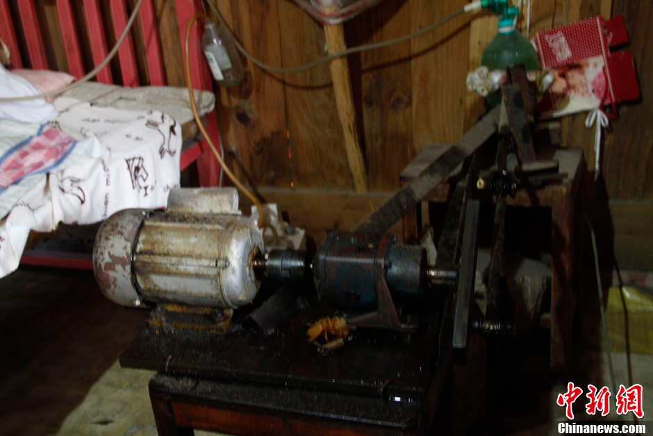 父母為癱瘓兒子自制呼吸機 手捏呼吸球5年不輟 父母為癱瘓兒子自制呼吸機 手捏呼吸球5年不輟