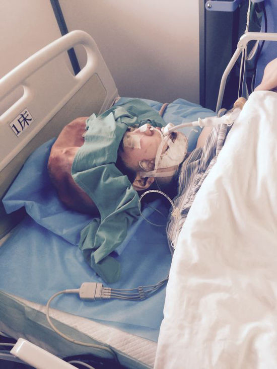 女海歸上海削骨整形 疑因術(shù)后出血誘發(fā)癲癇