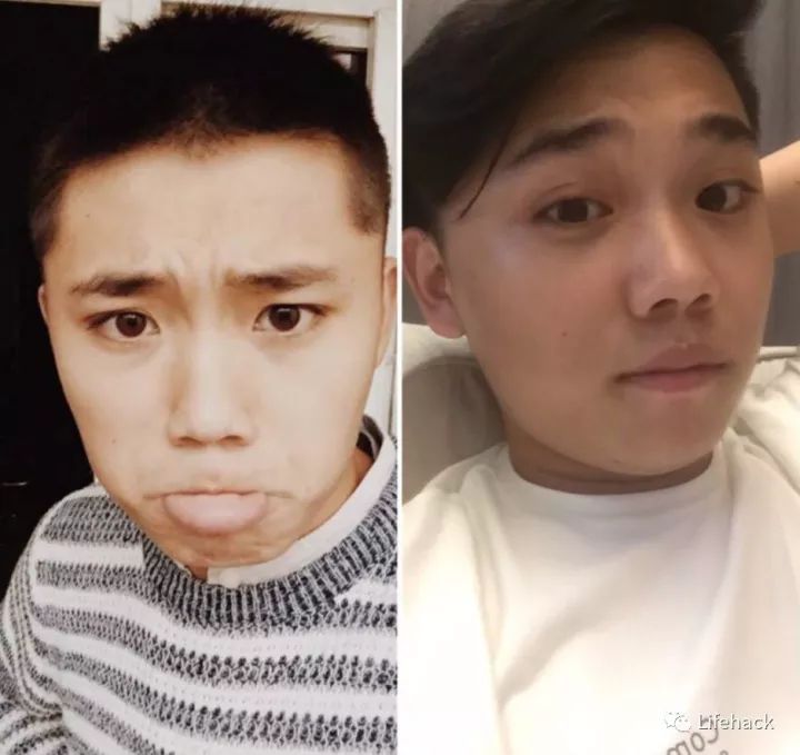 長胖20斤，臉型怎么變？這些例子看完扎心了！