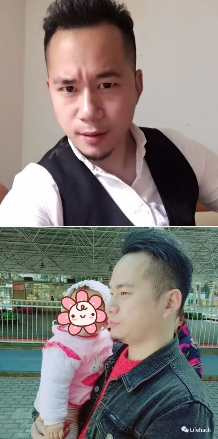 長胖20斤，臉型怎么變？這些例子看完扎心了！