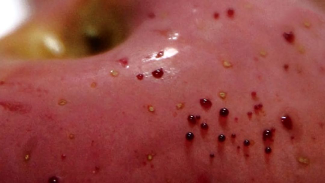 嚇懵！女子用熱水泡蘋果結果冒出血珠 咋回事？