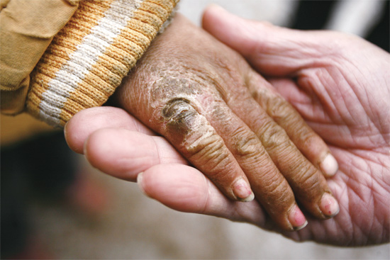 胡天格凍裂的小手撥動(dòng)了許多讀者的心弦