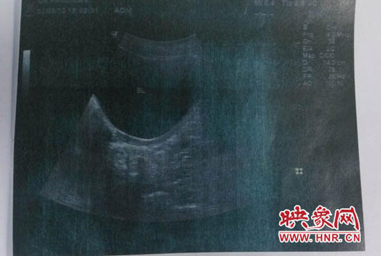 鄭州大學第三附屬醫(yī)院鑒定 鄭州大學第三附屬醫(yī)院鑒定