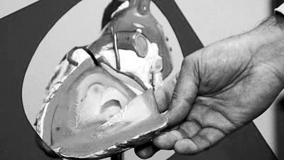 威廉斯領(lǐng)導(dǎo)的研究團(tuán)隊(duì)已經(jīng)利用人體脂肪干細(xì)胞，成功3D打印出心臟血管和心臟瓣膜，待一顆心臟的所有部件打