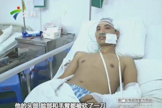 另一名傷者頭部、臉部和手臂都被砍了一刀。(視頻截圖)