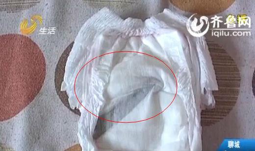 母親給女兒換紙尿褲 襠部現(xiàn)10厘米長(zhǎng)刀片 母親給女兒換紙尿褲 襠部現(xiàn)10厘米長(zhǎng)刀片