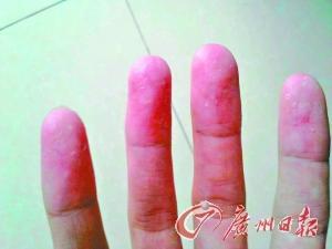 近百學(xué)生沒(méi)疊好被子遭體罰 校長(zhǎng):沒(méi)懲罰不叫教育