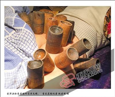 民間高人用火療治頑固性頭痛 圍觀者尖叫(圖) 民間高人用火療治頑固性頭痛 圍觀者尖叫(圖)