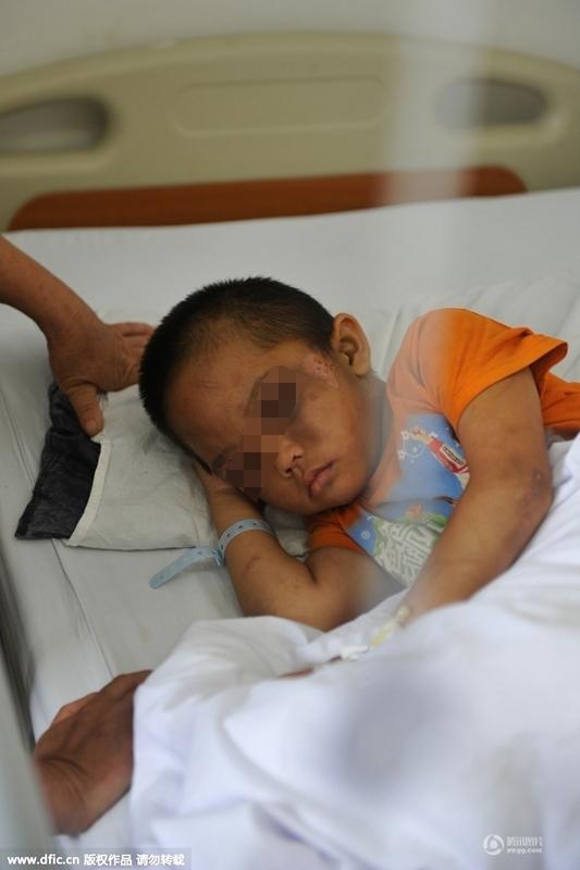 圖為全身傷痕累累的小進。