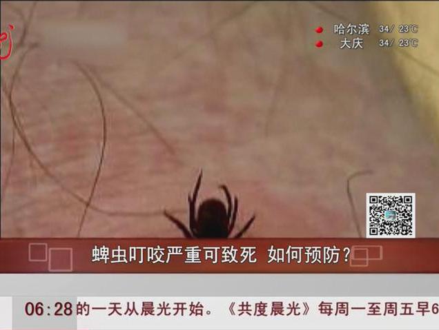 蜱蟲叮咬嚴(yán)重可致死如何預(yù)防？