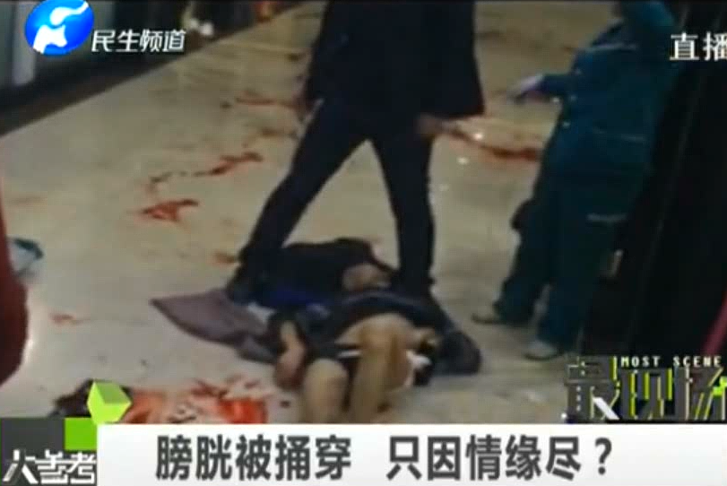 膀胱被捅穿 只因情緣盡？